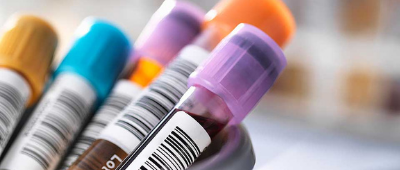 Fertility Blood Test Appointments Now Available at Superdrug Stores