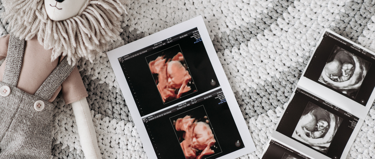 Struggling to conceive how to get pregnant faster