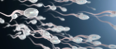 MALE FERTILITY: Why have a Sperm DNA Fragmentation Test?