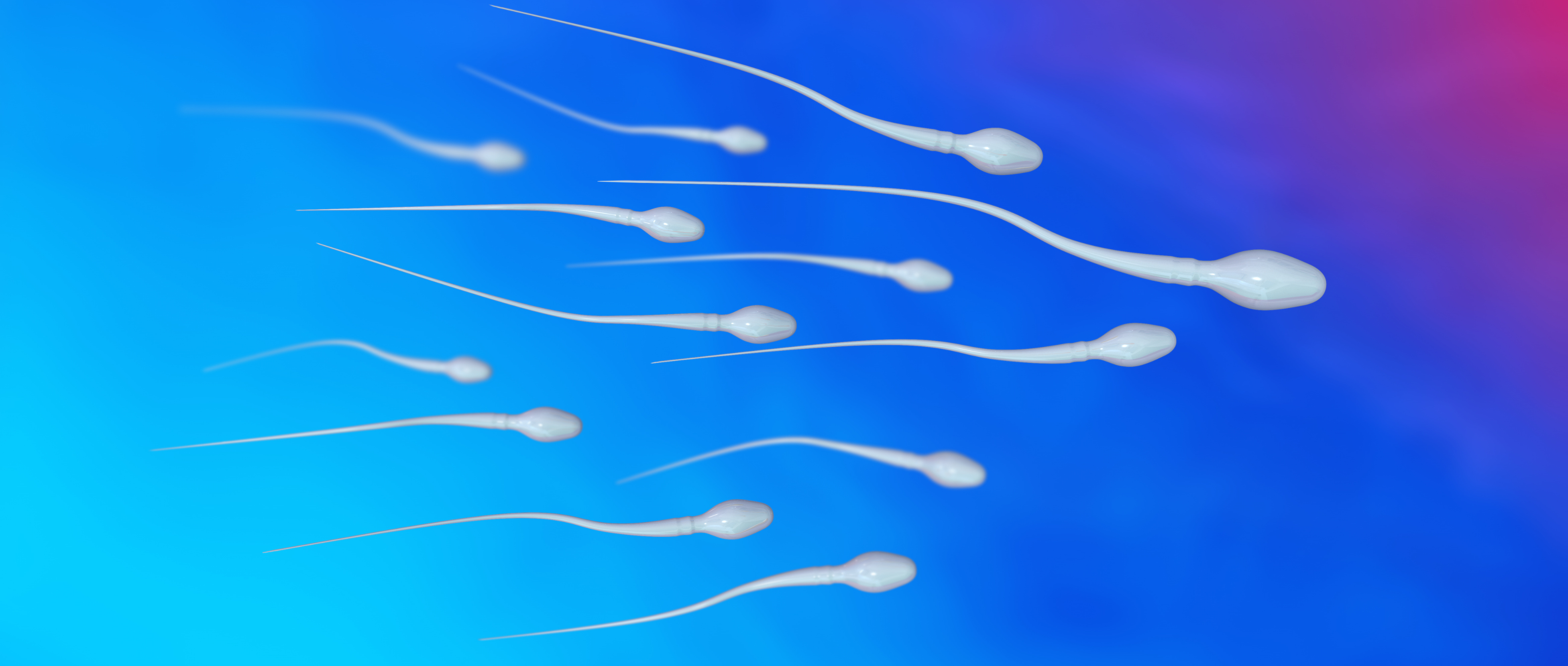ZyMot® Sperm Selection for IVF and ICSI: Supporting Better Outcomes in Male Factor Infertility